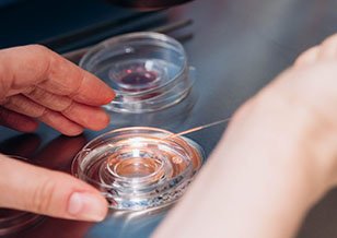 28 Case studies-In vitro fertilization