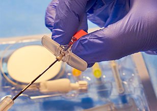 28 Case studies-Reciprocal IVF or ROPA Method