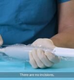 Egg retrieval in IVF.jpg